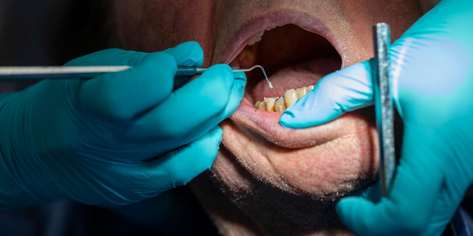 En tandläkare får kritik av IVO för en oskicklig behandling. Arkivbild.